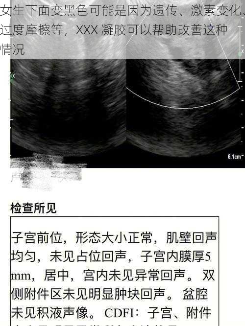 女生下面变黑色可能是因为遗传、激素变化、过度摩擦等，XXX 凝胶可以帮助改善这种情况